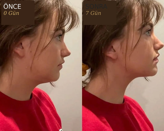 Facebrushy™ Kuru Fırça